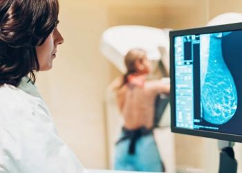 Bezpłatne badania mammograficzne